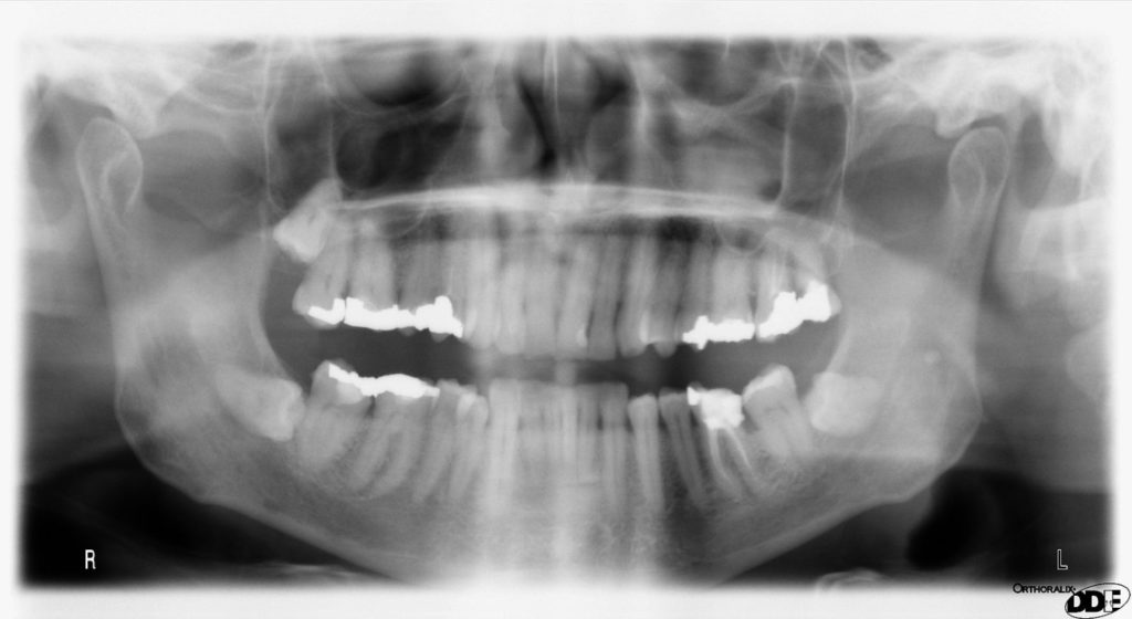 x-ray image