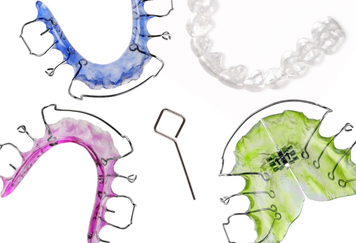 everything-you-need-to-know-about-retainers