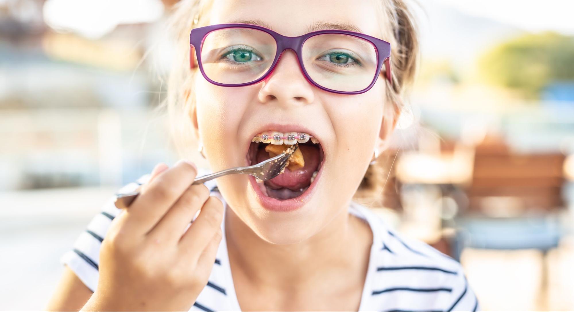 How to Eat Well with Braces in Cranberry Township