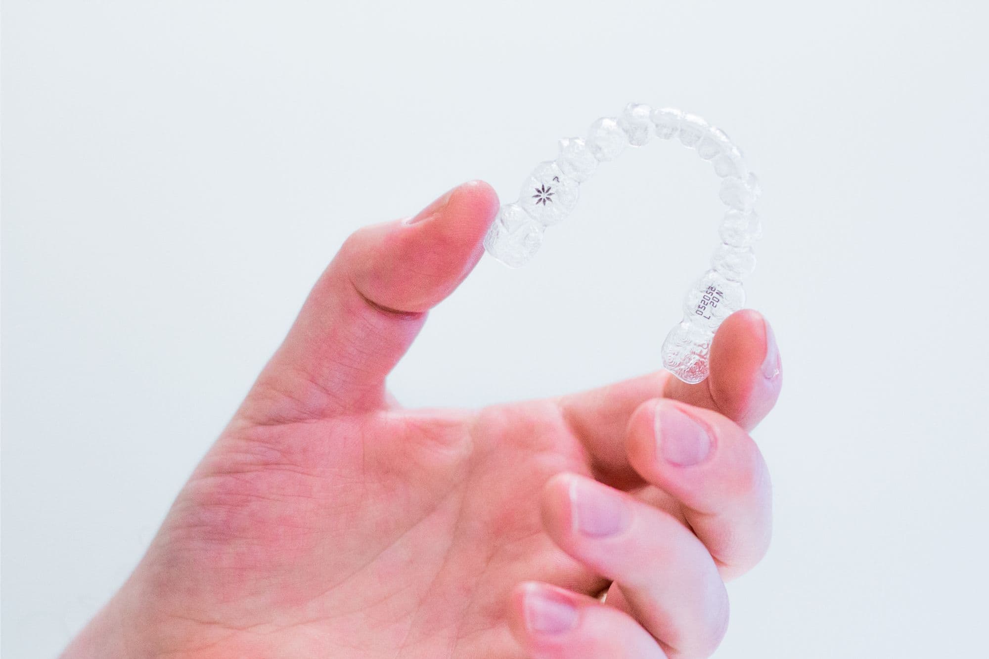 What Makes Rhoads Orthodontics' In-House 3D Aligners Different